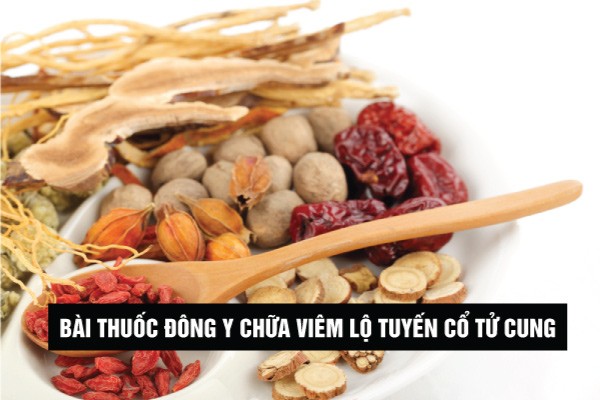 bài thuốc đông y chữa viêm lộ tuyến cổ tử cung