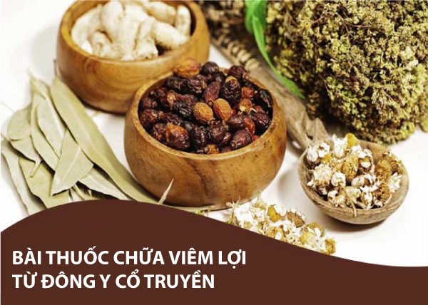 Chữa Viêm Lợi Bằng Đông Y