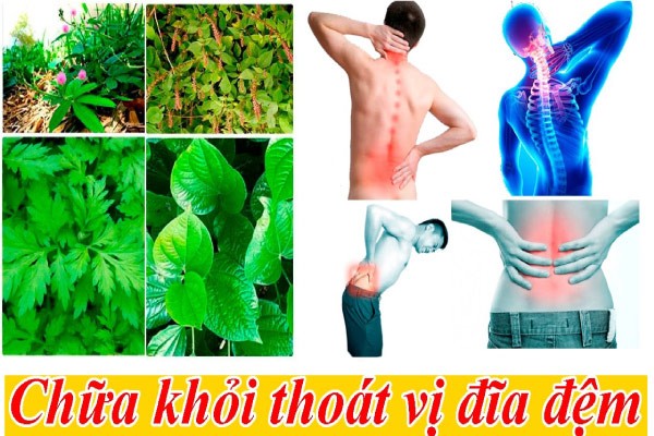 bài thuốc đông y chữa thoát vị đĩa đệm