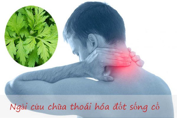 Chữa thoái hóa cột sống bằng ngải cứu