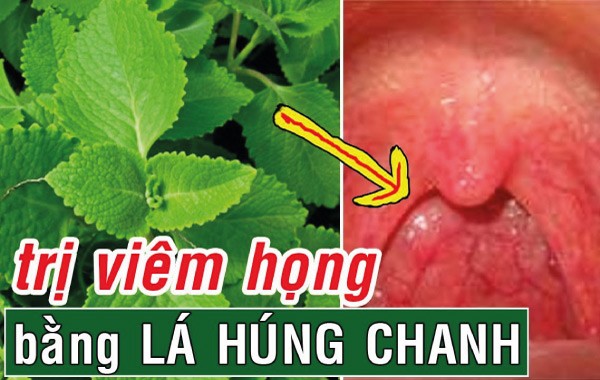 chữa viêm họng bằng lá húng chanh