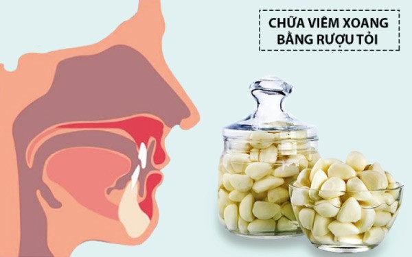 chữa viêm xoang bằng Rượu tỏi